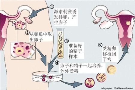 周顾问